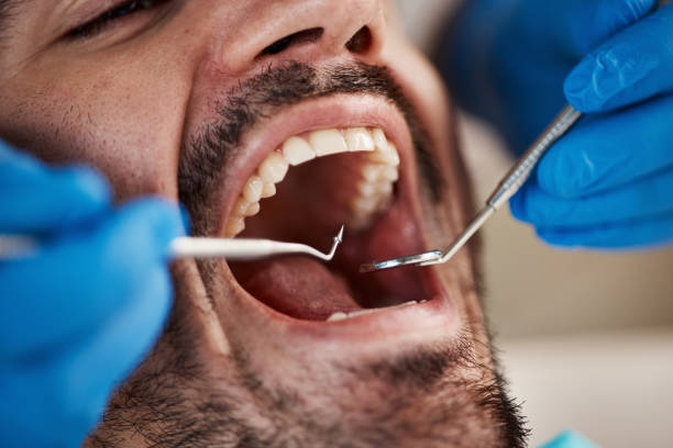 Best Emergency Wisdom Teeth Removal in Emsworth, PA